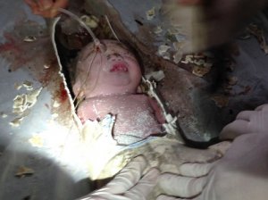 Новорождённого случайно смыли в канализацию